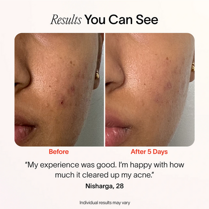 LumiÉclat™ Beauty Mask