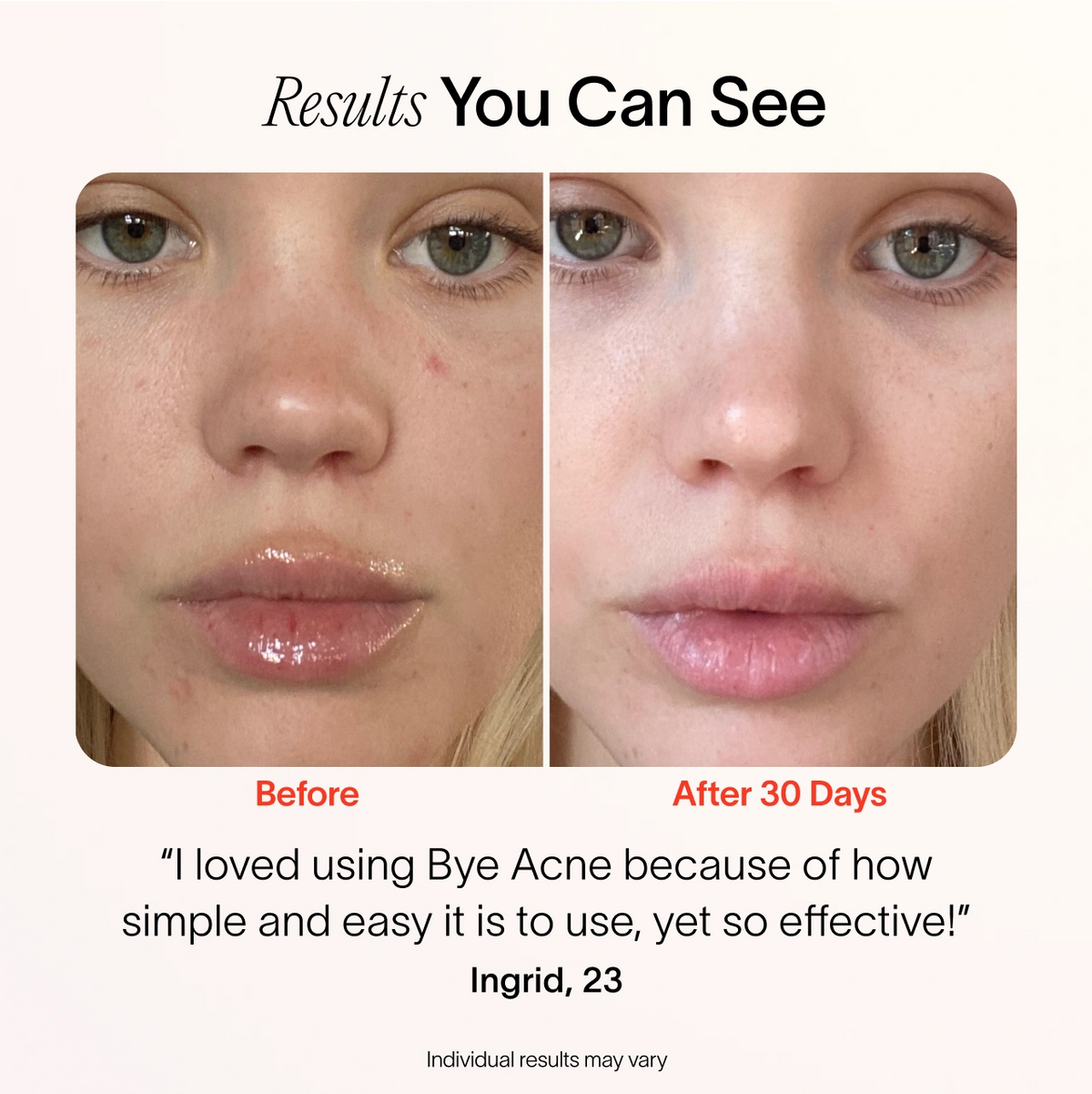 LumiÉclat™ Beauty Mask