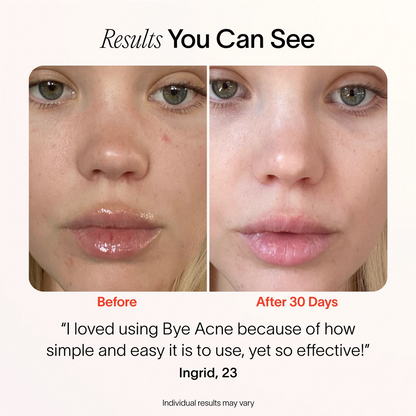 LumiÉclat™ Beauty Mask
