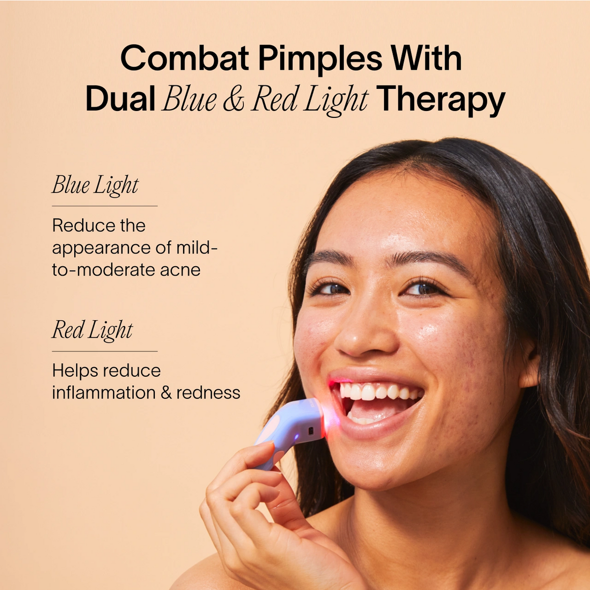 4-Minute Pimple Spot Treatment