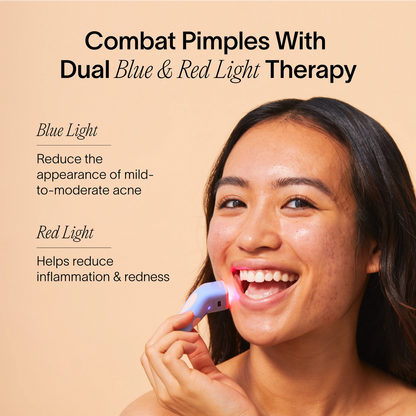4-Minute Pimple Spot Treatment