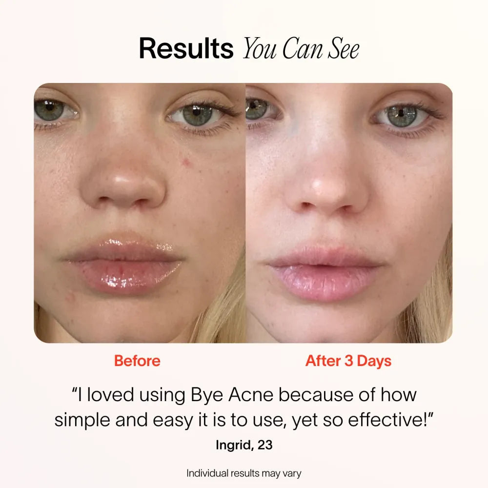 LumiÉclat™ Beauty Mask