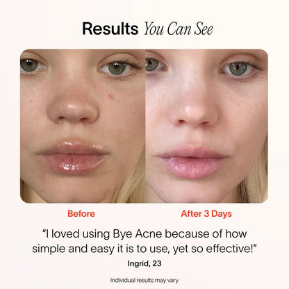 LumiÉclat™ Beauty Mask