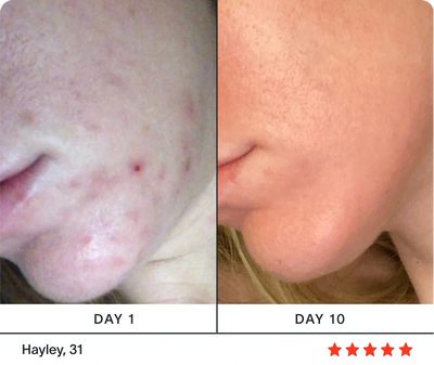 LumiÉclat™ Beauty Mask