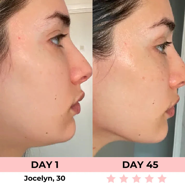 LumiÉclat™ Beauty Mask