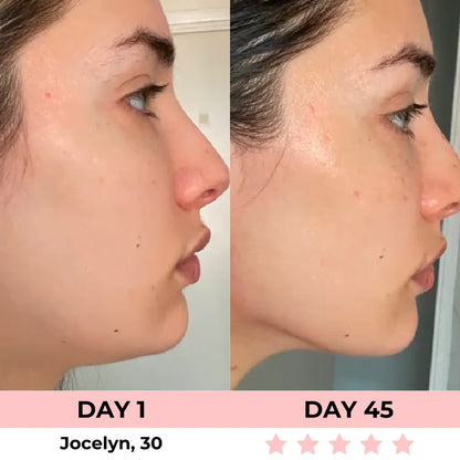 LumiÉclat™ Beauty Mask
